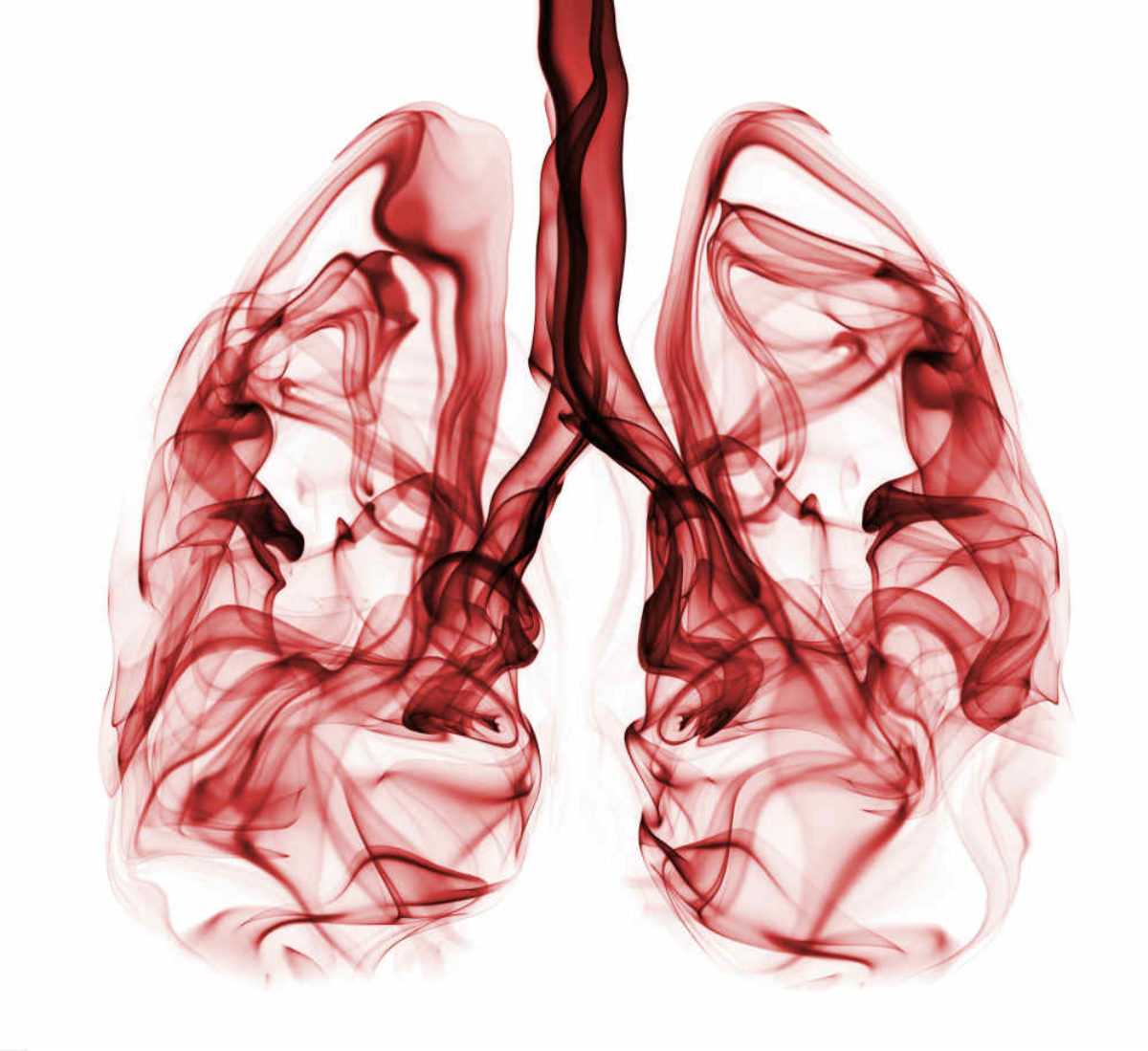 COPD: a fojtogató népbetegség