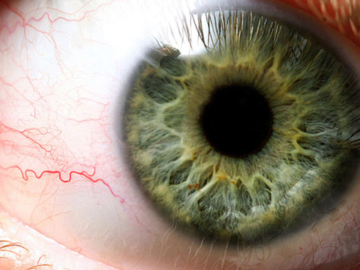 a látásvesztés glaukóma százaléka