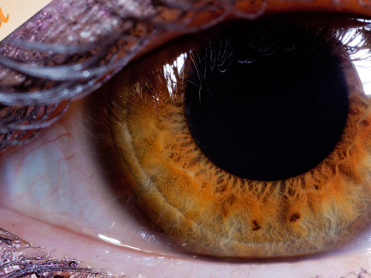 különféle látásvizsgálatok beist myopia