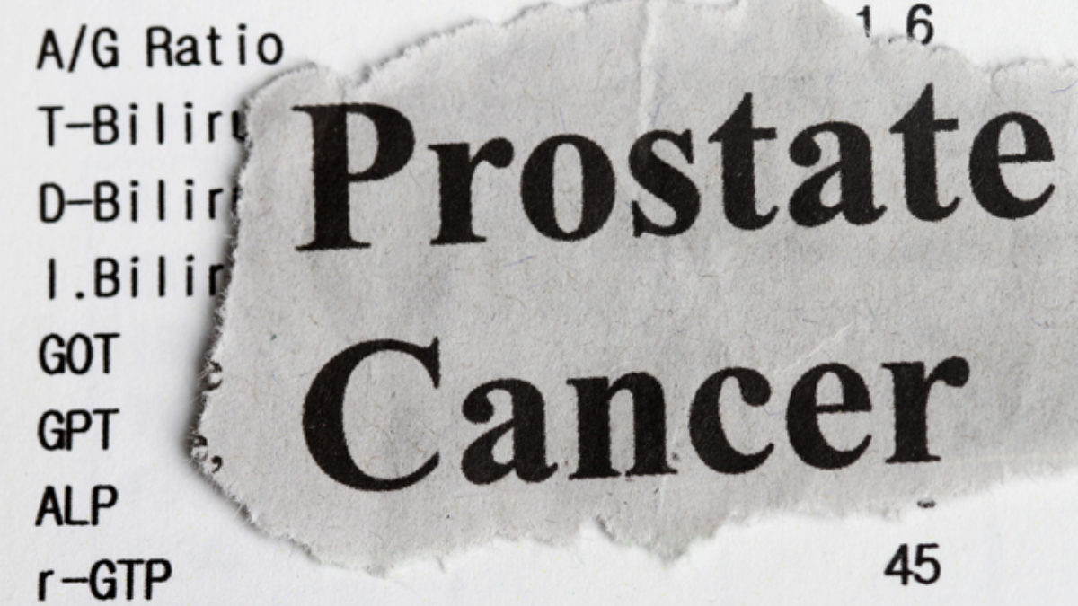 a prostatitis rákról 3 szakaszban