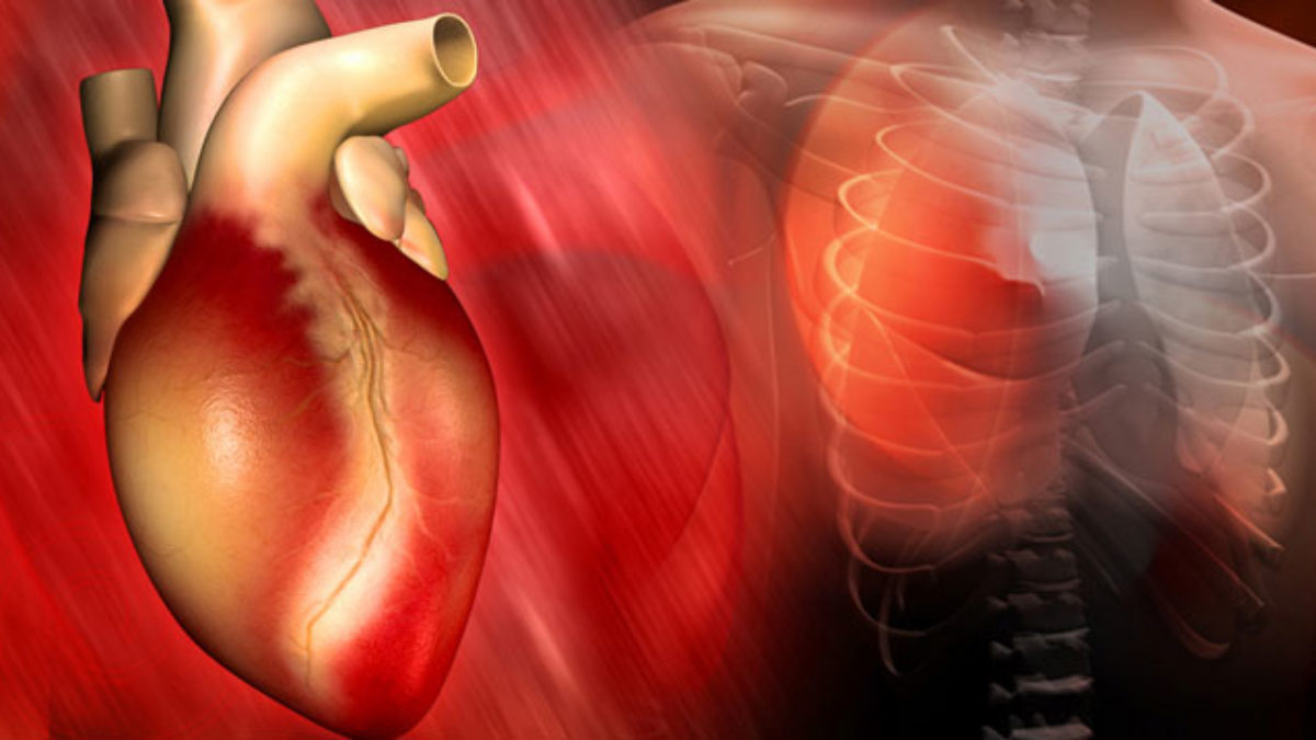 hogyan lehet meghatározni a szív egészségét társbetegségek a magas vérnyomásban
