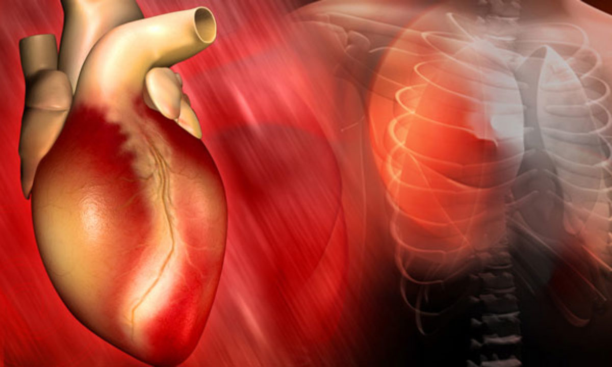30 éves nő szív egészsége magas vérnyomás 2 fokozat 3 kockázati fokozat