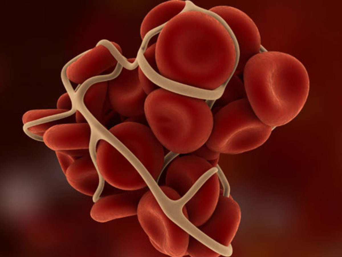 webmd szív egészsége a vörösbor előnyei a magas vérnyomás ellen