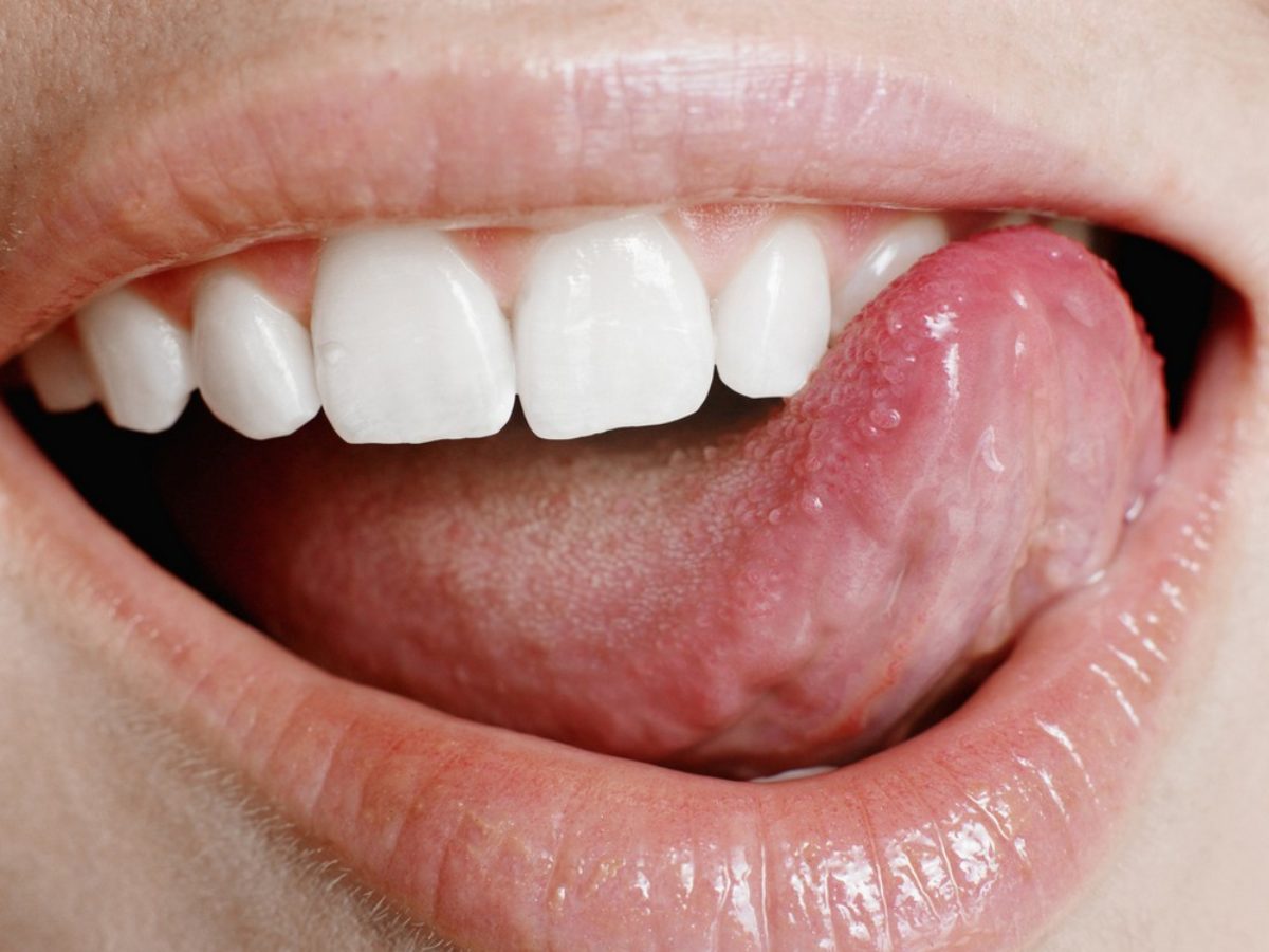 keserűség a szájban magas vérnyomás esetén hipertóniás arcszín