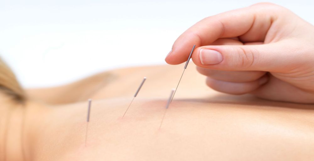 akupunktúrás fájdalomcsillapítás
