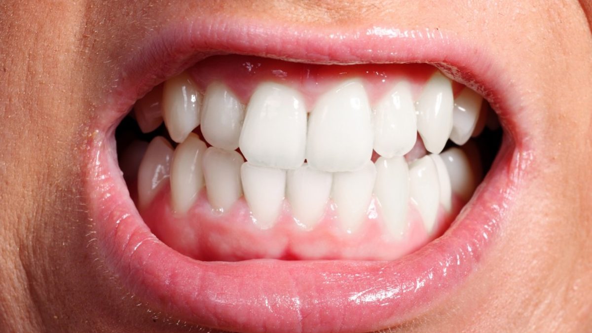 Hogyan javíthatja a testmozgás a száj egészségét?