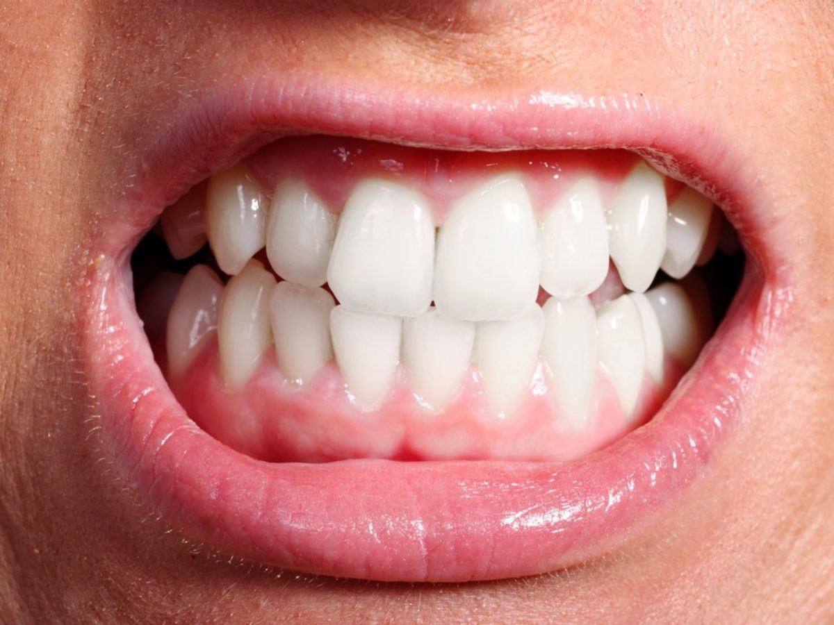 rossz fog okozhat fogyást 7 csatorna fogyás
