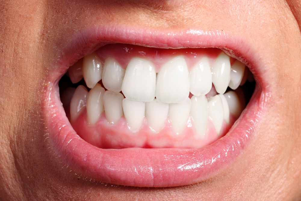Egészséges fogak és íny? Hogyan lehetséges? - Vitaking Kft.