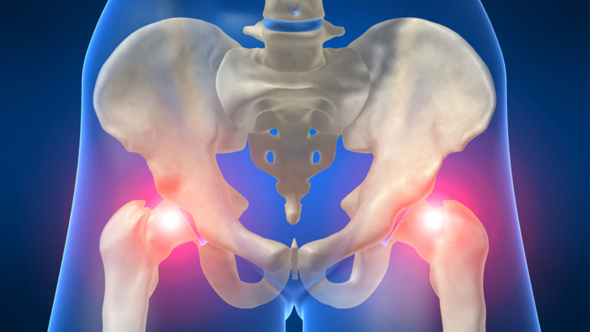 csípőfájdalom ortopéd