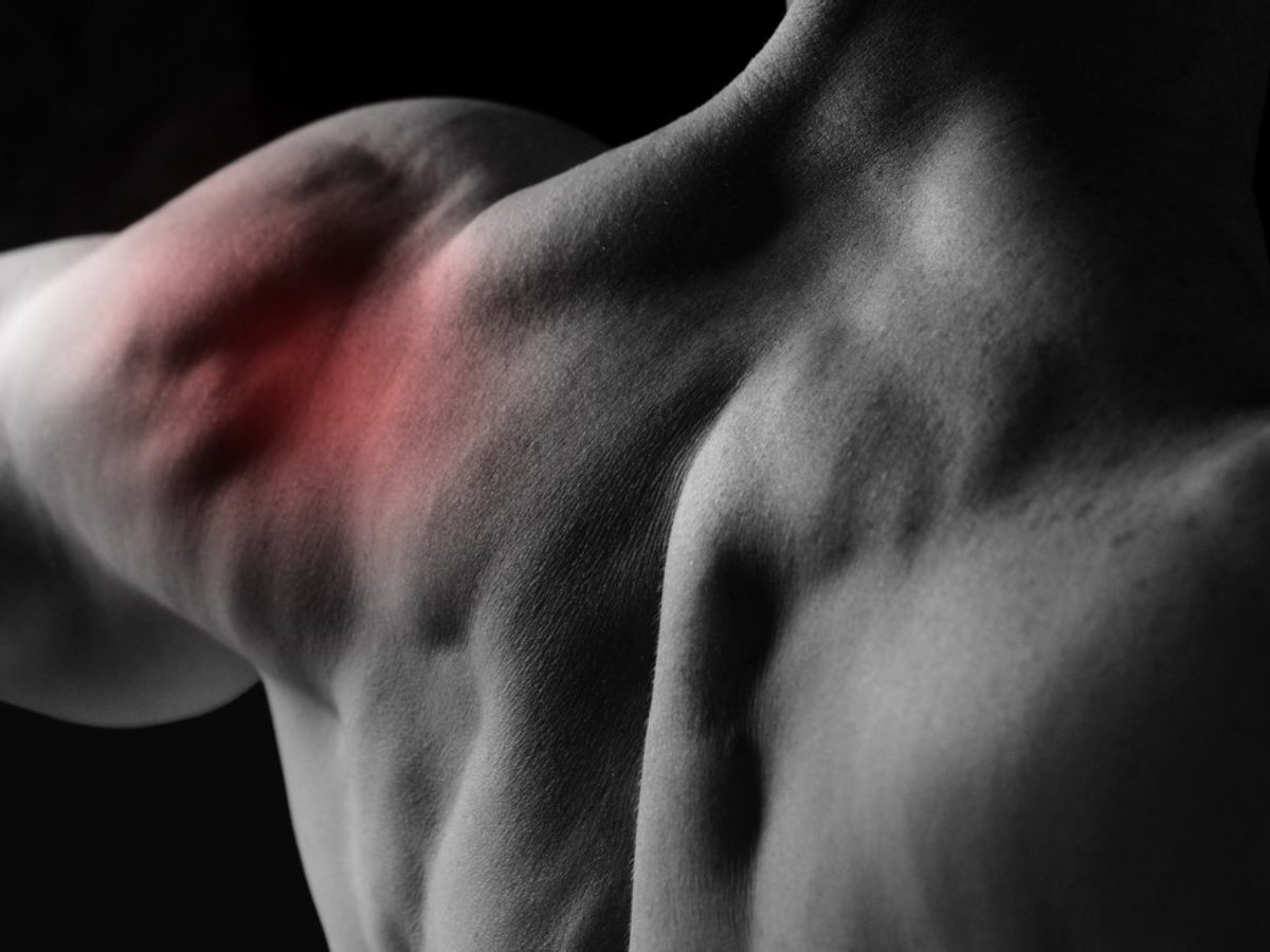 [Scapular dyskinesis: the origo of shoulder lesions?]