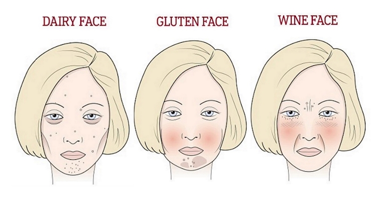 Viszketés és vörös arc - Cukorbetegség is okozhatja - Vörös foltok cukorbetegséggel az arcon