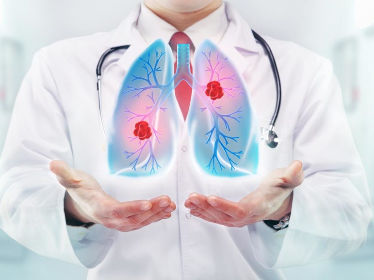 emphysema fogyást okozhat Fogyás az 50 év feletti férfiak számára