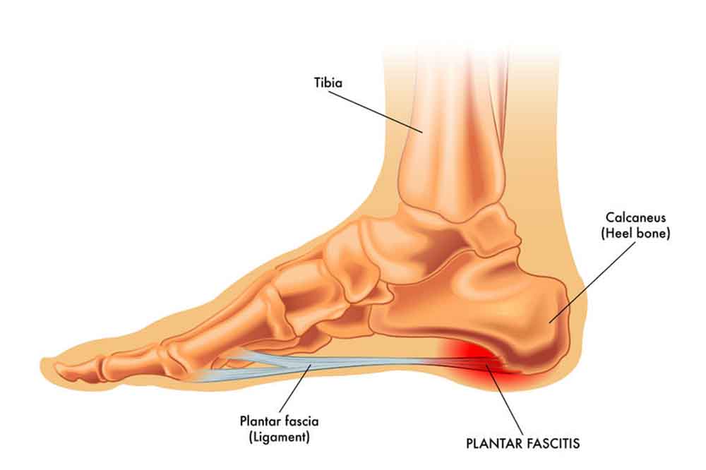 A láb fáj az ízületekről. Hogyan zajlik a lábfej fájdalom kezelése