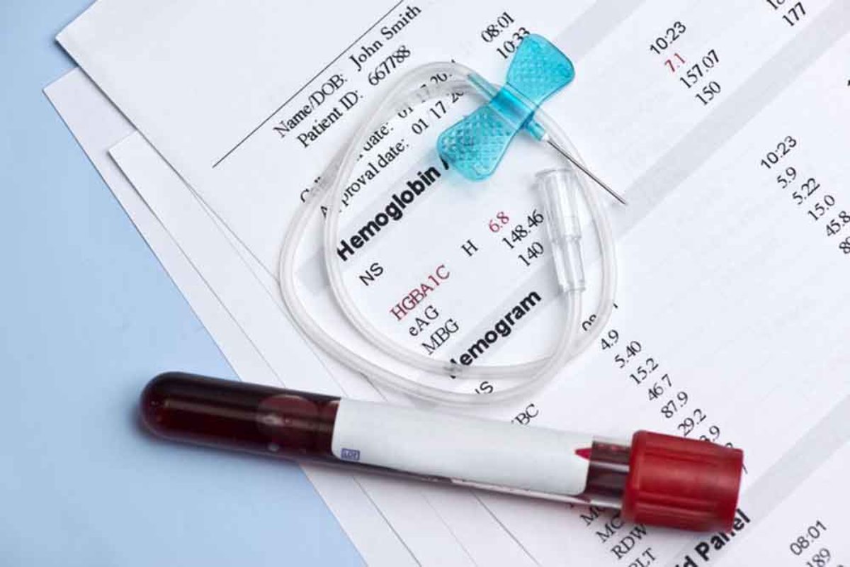 trigliceridek magas mit jelent phimosis kezelés során a diabetes