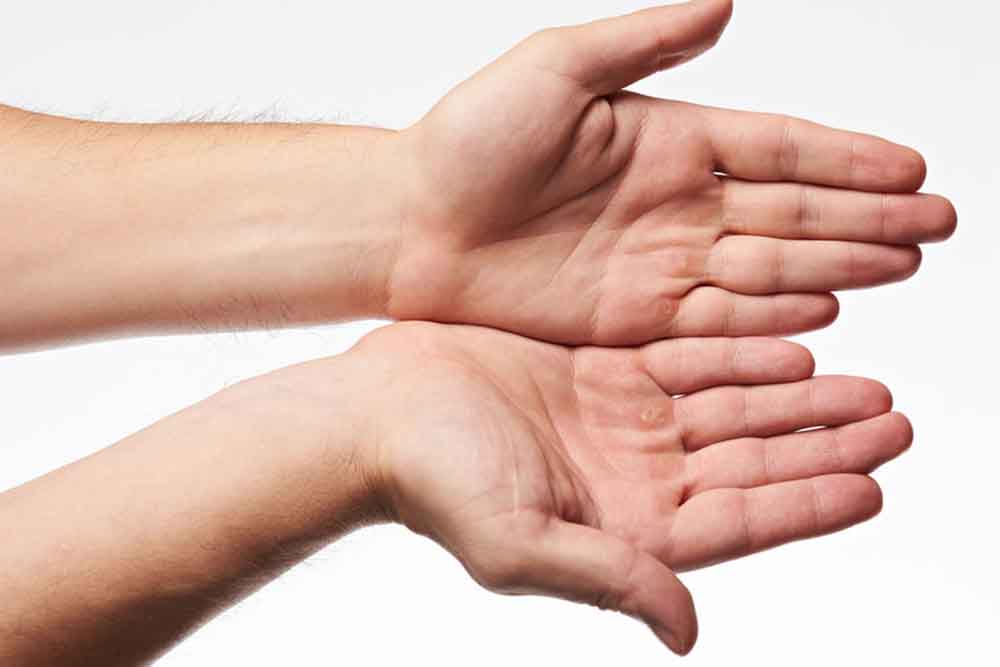 fájdalom a jobb kéz tenyér ízületében hogyan kenjük be a hátat derékfájással