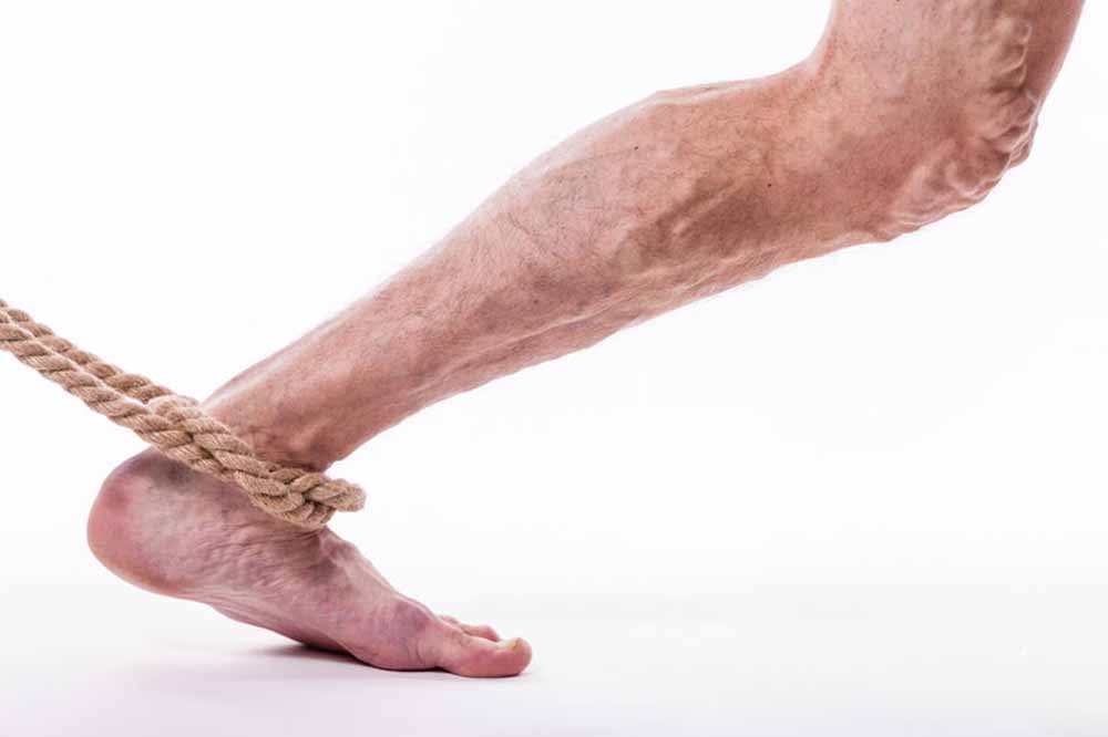 Ayurveda a lábak visszérgyulladására hatékony módszer a varikózis kezelésére a lábakon