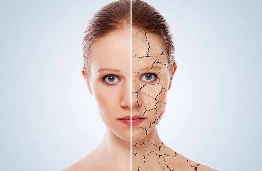 A bőr alatti zsír az arcán: honnan származik és hogyan lehet megszabadulni - Kozmetikus