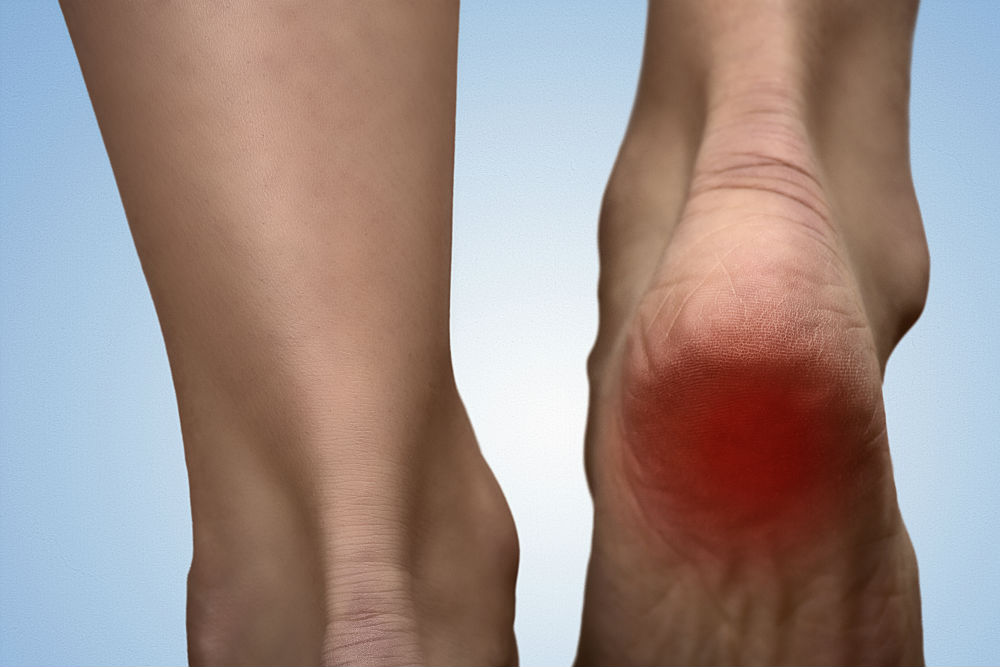 A lábujjak deformációi artritiszben, Talp és lábujjak fájdalma