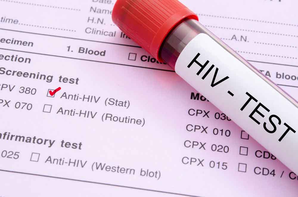 HIV-vel élőknek