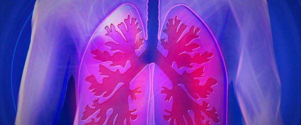COPD, tüdő