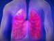 COPD, tüdő