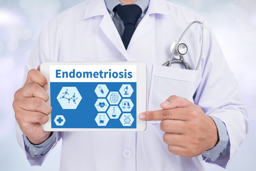 endometriózis