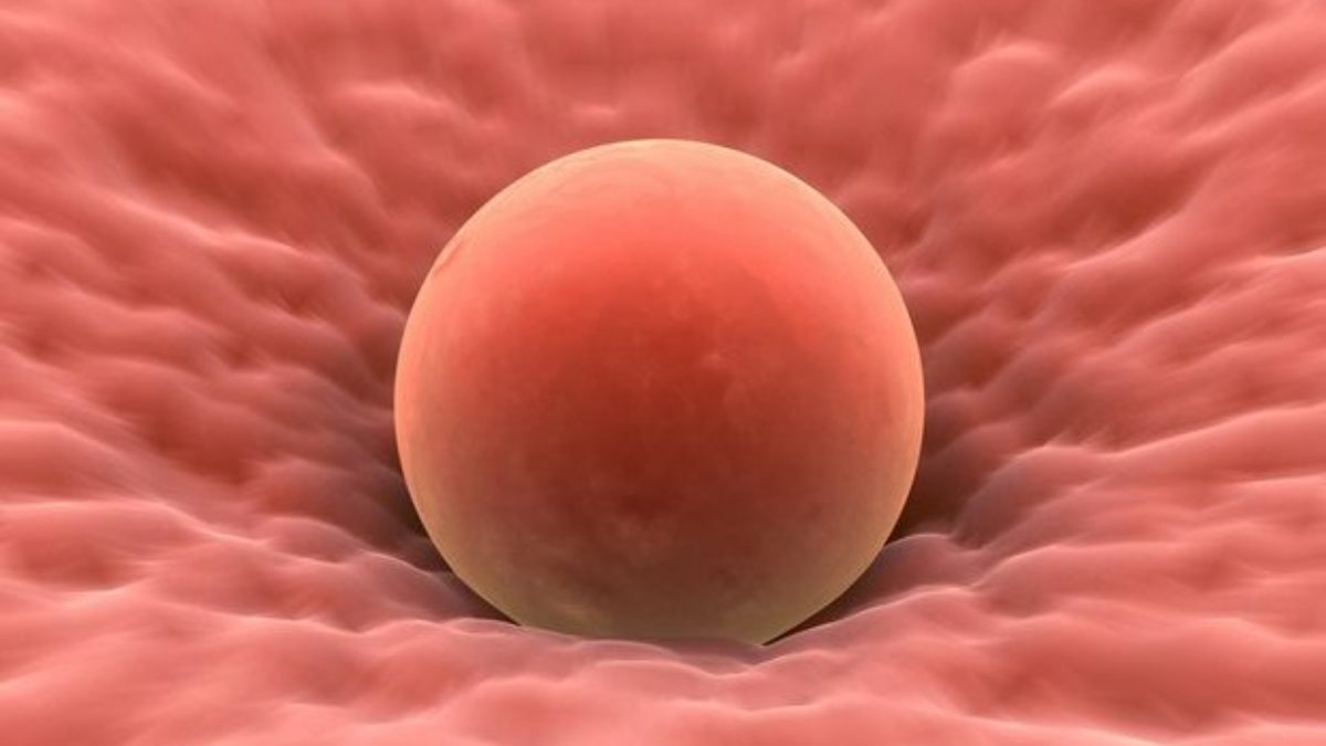 Mesterséges megtermékenyítés (IVF) - Babát tervező - Állapotod - Libero